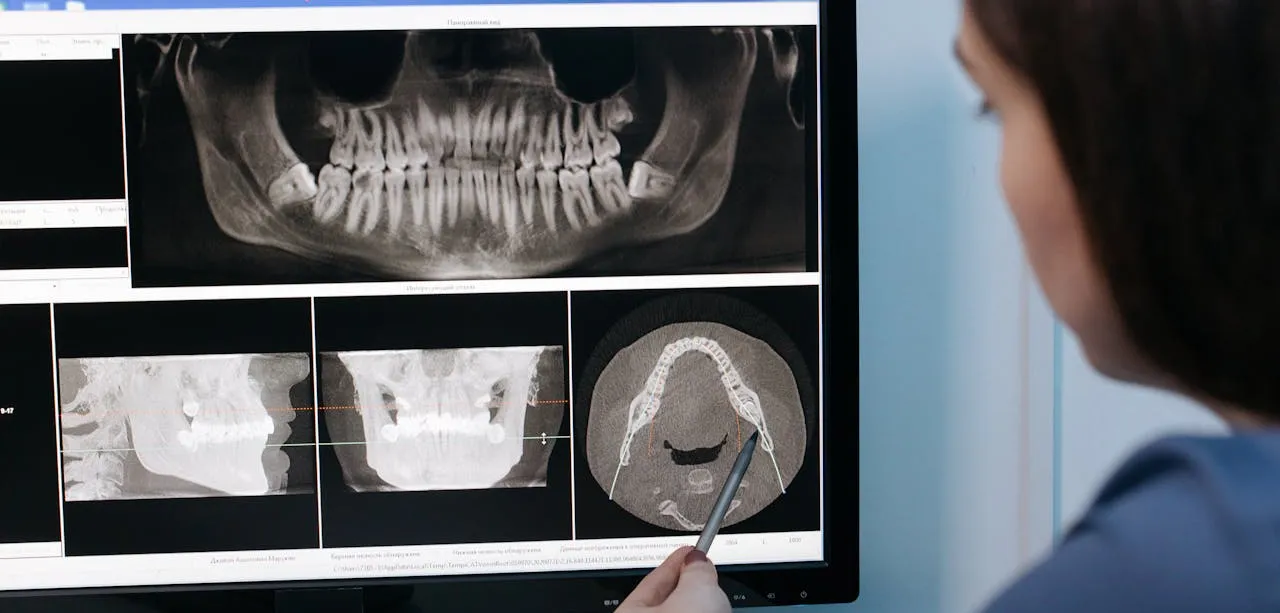 Dentistry, xrays